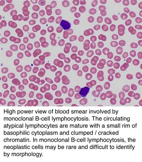 Monoclonal B.